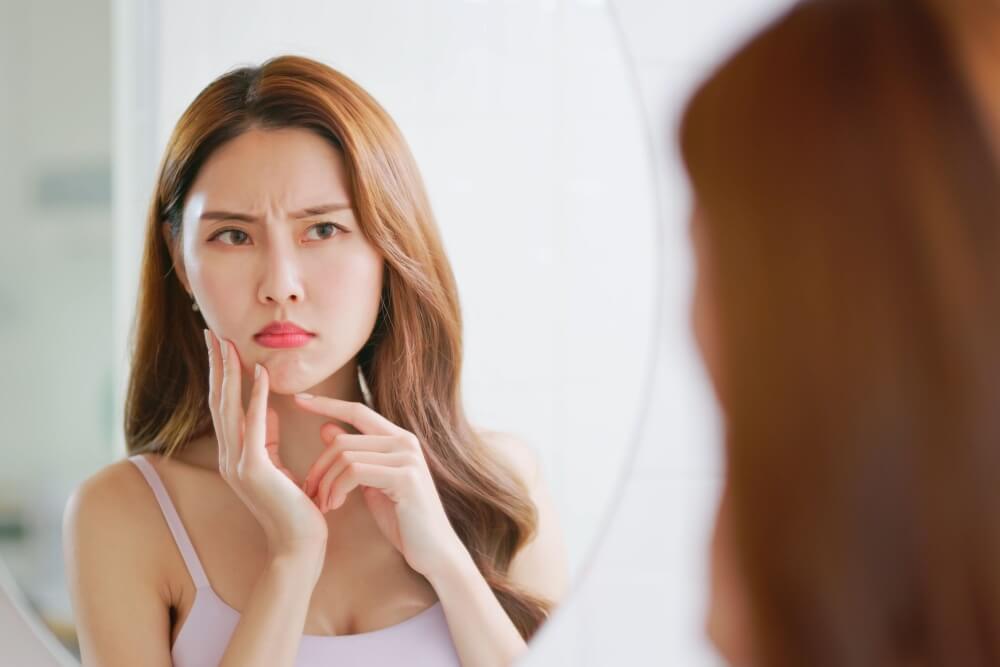 痘疤怎麼消除?及早治療可大幅降低留下疤痕的機會