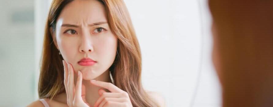 痘疤怎麼消除?及早治療可大幅降低留下疤痕的機會